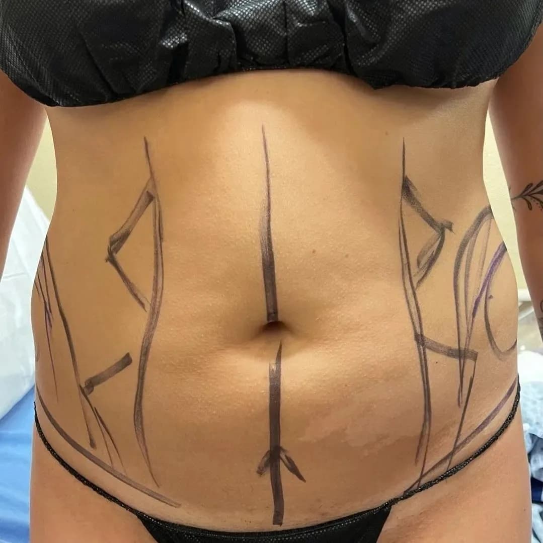 Dr. Anatolie Taran