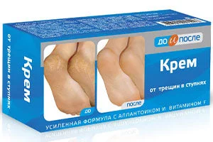 Do i posle Crema picioare c/a crapaturilor 150ml